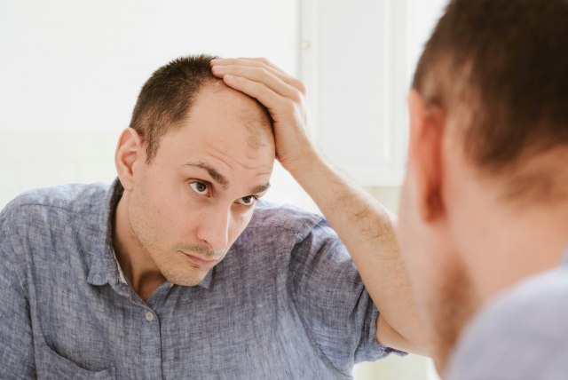 Doktor rešio dilemu: Previše masturbacije izaziva gubitak kose